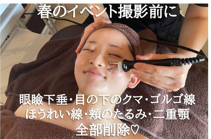ゴルゴ線　ほうれい線　クマ　たるみ